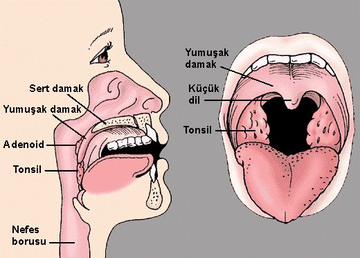 Bademcik Bulaşıcı mıdır??