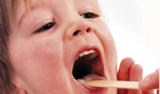 Bademcik Düşmesi Tedavi Süreci