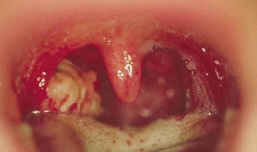 Bademcik Ne İşe Yarar?