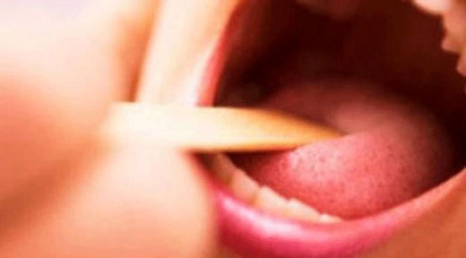 İnmeyen Bademcik Belirtileri ve Tedavisi