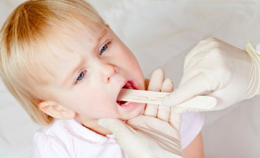 Tekrarlayan Bademcik İltihabı Belirtileri ve Tedavisi